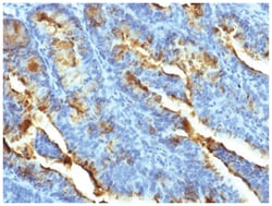 FSHR Antibody (FSHR/1400) - Azide and BSA Free, Novus Biologicals:Antibodies:Primary