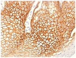 gamma Catenin Antibody (CTNG/1664), Novus Biologicals:Antibodies:Primary