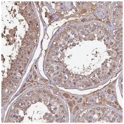 Glutamate Dehydrogenase Antibody, Novus Biologicals 25 &mu;L:Anticorps,