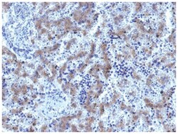Glypican 3 Antibody (GPC3/1534R) - Azide and BSA Free, Novus Biologicals