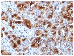 GP2 Antibody (GP2/1712), Novus Biologicals 20&mu;g; Unlabeled:Antibodies,