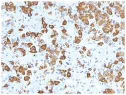 Growth Hormone Antibody (GH/1371) - Azide and BSA Free, Novus Biologicals