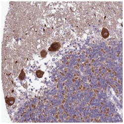 Hippocalcin Antibody, Novus Biologicals 25 &mu;L:Antibodies, Polyclonal