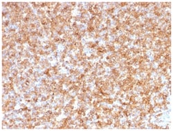 HLA DQ/DR/DP Antibody (CR3/43) - Azide and BSA Free, Novus Biologicals