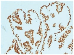 HNF-3 alpha/FoxA1 Antibody (FOXA1/1515) - Azide and BSA Free, Novus Biologicals:Antibodies:Primary