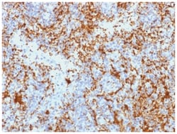 Integrin beta 3/CD61 Antibody (Y2/51) - Azide and BSA Free, Novus Biologicals 100 &mu;g | Buy Online | Novus Biologicals | Fisher Scientific