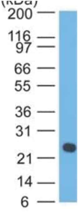 Lambda Light Chain Antibody (HP6054), Novus Biologicals:Antibodies:Primary
