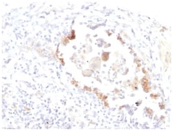 Lewis Y Antibody (LWY/1463) - Azide and BSA Free, Novus Biologicals:Antibodies:Primary