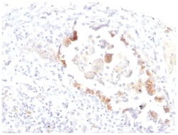 Lewis Y Antibody (LWY/1463) - Azide and BSA Free, Novus Biologicals 200&mu;g;