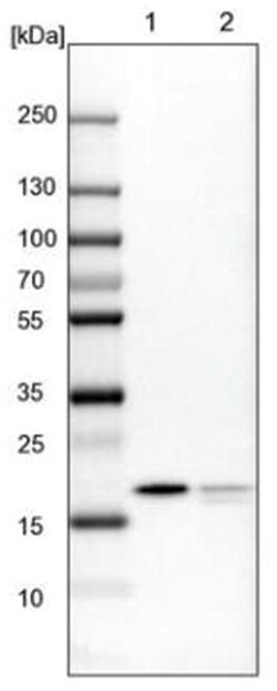 MRLC2 Antibody, Novus Biologicals 100&mu;L; Unlabeled:Antibodies, Polyclonal