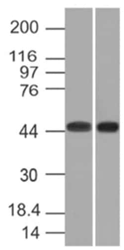 Napsin A Antibody (NAPSA/1239) - BSA Free, Novus Biologicals 100&mu;g;