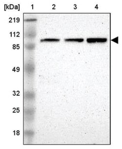 Nbs1 Antibody, Novus Biologicals 100&mu;L; Unlabeled:Antibodies, Polyclonal