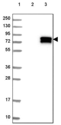 NF-L Antibody, Novus Biologicals 25 &mu;L:Antibodies, Polyclonal
