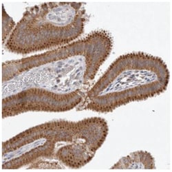 Niemann-Pick C1 Antibody, Novus Biologicals 25 &mu;L:Antibodies, Polyclonal