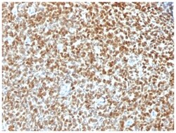 NKX2.2 Antibody (NX2/1422R), Novus Biologicals 20&mu;g; Unlabeled:Antibodies,