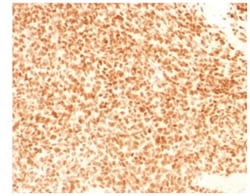 NKX2.2 Antibody (NX2/1524), Novus Biologicals:Antibodies:Primary Antibodies