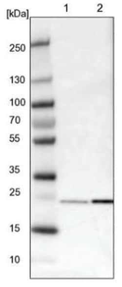 Park7/DJ-1 Antibody, Novus Biologicals 100&mu;L; Unlabeled:Antibodies,