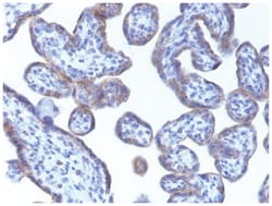 Perilipin-2/ADFP Antibody (ADFP/1493) - Azide and BSA Free, Novus Biologicals:Antibodies:Primary