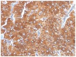 Perilipin-2/ADFP Antibody (ADFP/1494), Novus Biologicals 20&mu;g; Unlabeled:Antibodies,