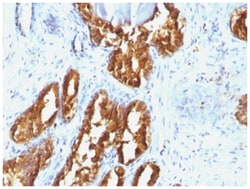 Prostatic Acid Phosphatase/ACPP Antibody (ACPP/1338) - Azide and BSA Free,