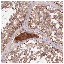 Pyruvate Dehydrogenase E1-alpha subunit Antibody, Novus Biologicals 100&mu;L;