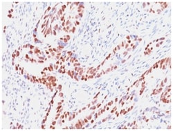 RB1 Antibody (SPM353), Novus Biologicals 200&mu;g; Unlabeled:Antibodies,