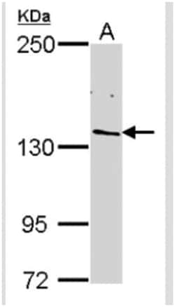 RPB2 Antibody, Novus Biologicals 0.1mL; Unlabeled:Antibodies, Polyclonal