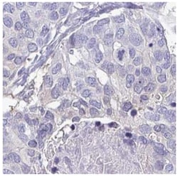 SCP3/SYCP3 Antibody, Novus Biologicals 25 &mu;L:Antibodies, Polyclonal