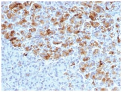 Serpin A3/alpha 1-Antichymotrypsin Antibody (AACT/1452) - Azide and BSA