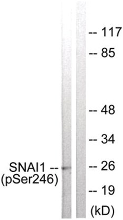 Snail, p Ser246 Antibody, Novus Biologicals 0.1mg; Unlabeled:Antibodies,