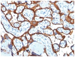 TfR (Transferrin R) Antibody (TFRC/1817), Novus Biologicals:Antibodies:Primary