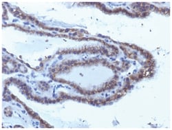 TSHR Antibody (SPM223) - Azide and BSA Free, Novus Biologicals:Antibodies:Primary