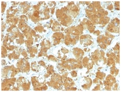 TSHR Antibody (TSHRA/1402) - Azide and BSA Free, Novus Biologicals:Antibodies:Primary
