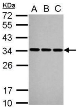 U1A Antibody, Novus Biologicals 100&mu;L; Unlabeled:Antibodies, Polyclonal
