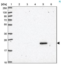 Ubiquitin B Antibody, Novus Biologicals 25 &mu;L:Antibodies, Polyclonal