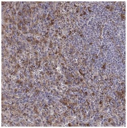 Zyxin Antibody, Novus Biologicals 25 &mu;L; Unconjugated:Antibodies, Polyclonal