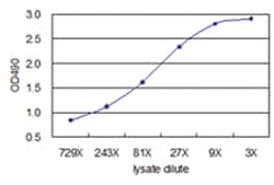 anti-AHSG, Human, Matched Antibody Pair, Abnova 1 Set:Antibodies, Monoclonal/Polyclonal