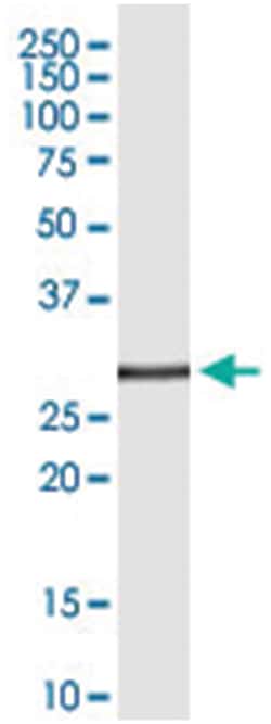 anti-TNFSF8, Clone: 1E1., Abnova 100 &mu;g | Buy Online | Abnova Corporation | Fisher Scientific