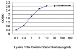 anti-CNN1, Human, Matched Antibody Pair, Abnova 1 Set | Buy Online | Abnova Corporation | Fisher Scientific