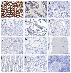 CPS1 (817-836) Mouse anti-Human, Clone: 5F5, Abnova 100&mu;g; Unlabeled:Antibodies,