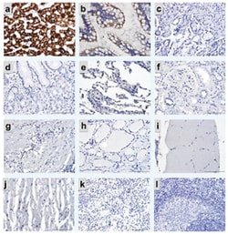 CPS1 (817-836) Mouse anti-Human, Clone: 5F5, Abnova 100&mu;g; Unlabeled:Antibodies,