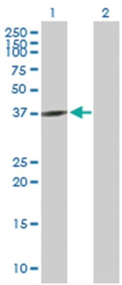 guanine nucleotide binding protein (G protein), q polypeptide, Mouse, Purified