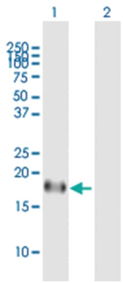 inhibitor of DNA binding 4, dominant negative helix-loop-helix protein,