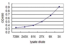 KIT, Human, Matched Antibody Pair (AP42), Abnova&trade;
