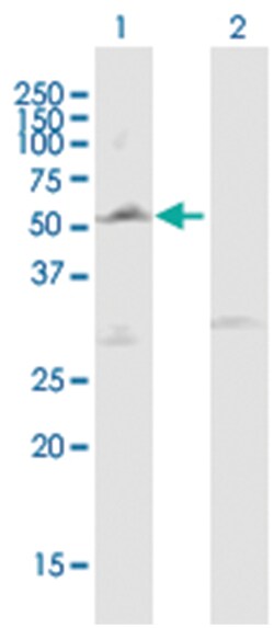 lipoprotein lipase, Mouse, Purified MaxPab Polyclonal Antibody, Abnova