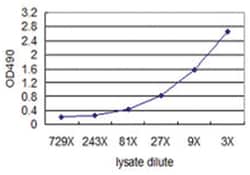 MUC1, Human, Matched Antibody Pair (AP41), Abnova™