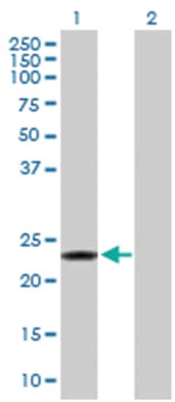 recoverin, Rabbit, Purified MaxPab Polyclonal Antibody, Abnova 100&mu;g;