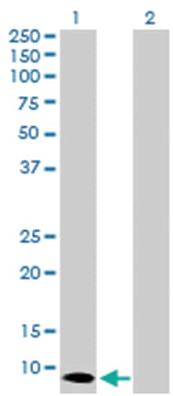 S100 calcium binding protein A7 (D01P), Rabbit anti-Human, Purified MaxPab™ Polyclonal Antibody, Abnova™