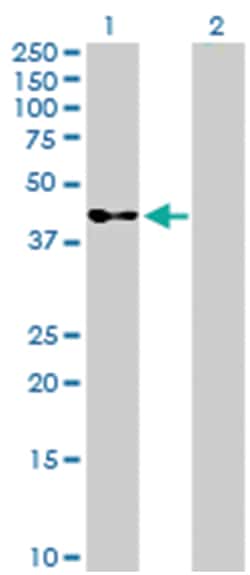 serpin peptidase inhibitor, clade B (ovalbumin), member 3 (D01P), Rabbit anti-Human, Purified MaxPab™ Polyclonal Antibody, Abnova™