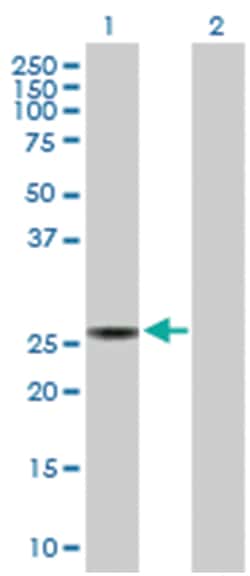 sepiapterin reductase (7,8-dihydrobiopterin:NADP+ oxidoreductase), Rabbit, Purified MaxPab™ Polyclonal Antibody, Abnova™